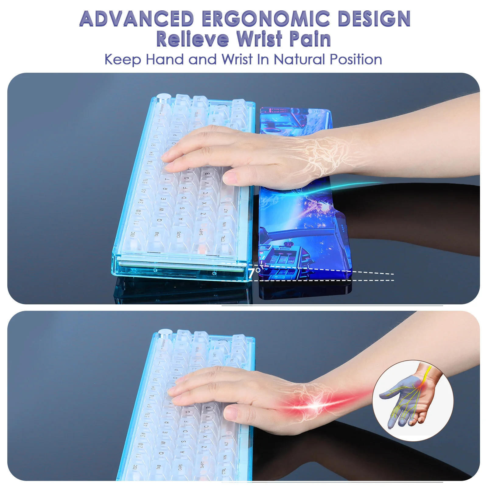 ATTACK SHARK Acrylic Wrist Rest with Pattern 5 ATTACK SHARK Acrylic Wrist Rest with Pattern